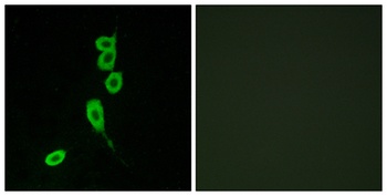 MC1-R antibody