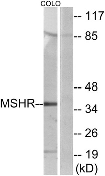 MC1-R rabbit pAb