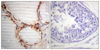 MCM4 antibody