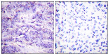 MDM2 (phospho Ser166) rabbit pAb