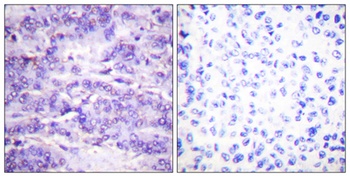 MDM2 (phospho-Ser166) antibody