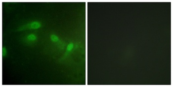 MDM2 (phospho Ser186/S188) rabbit pAb
