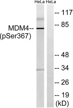 MDMX (phospho Ser367) rabbit pAb
