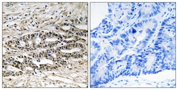 MDMX antibody