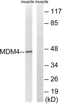 MDMX rabbit pAb