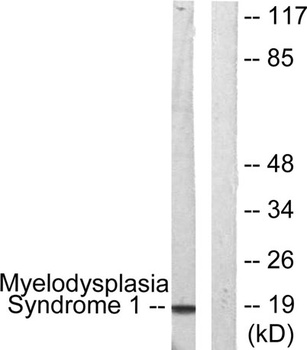 PRDM3 antibody