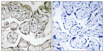 ME2 rabbit pAb Antibody