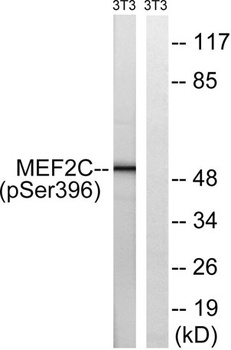 MEF-2C (phospho Ser396) rabbit pAb