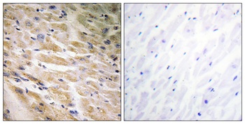 MEF-2C (phospho-Ser387) antibody