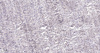 MEF-2C antibody