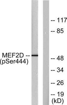 MEF-2D (phospho Ser444) rabbit pAb
