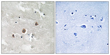 MEK Kinase-1 (phospho Thr1402) rabbit pAb