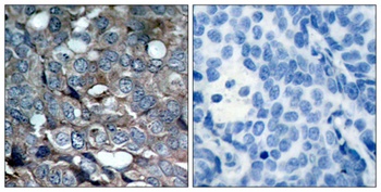 ASK 1 (phospho Ser83) rabbit pAb