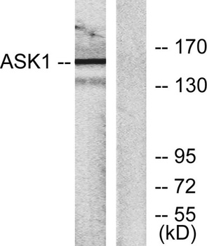 ASK 1 antibody