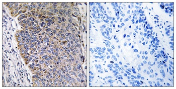MGST3 rabbit pAb Antibody