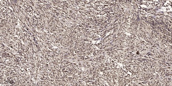 MITF (phospho-Ser180) antibody