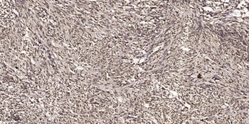 MITF (phospho Ser180) rabbit pAb