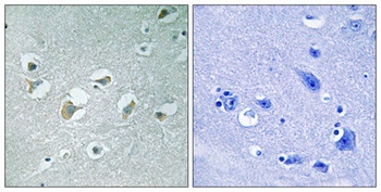 MLK1/2 (phospho-Thr312/266) antibody