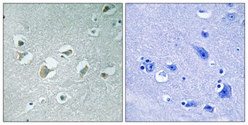 MLK1/2 (phospho Thr312/266) rabbit pAb