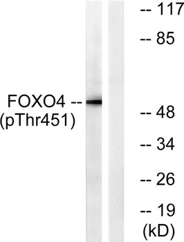 FoxO4 (phospho-Thr451) antibody