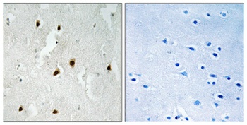 FoxO4 (phospho Ser262) rabbit pAb
