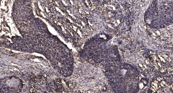 MMP-15 antibody