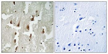MNDA rabbit pAb