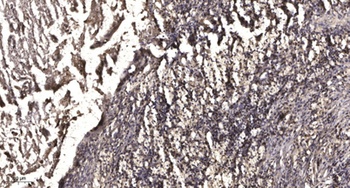MRE11 (phospho-Ser264) antibody