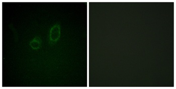 Moesin/Ezrin/Radixin (phospho Thr558) rabbit pAb