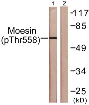 Moesin/Ezrin/Radixin (phospho Thr558) rabbit pAb