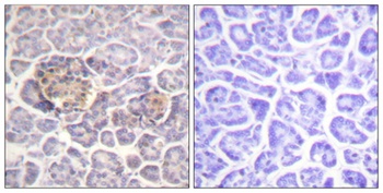 Moesin/Ezrin/Radixin rabbit pAb