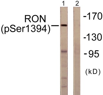 Ron (phospho Ser1394) rabbit pAb