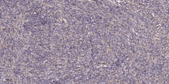 Ron (phospho Ser1394) rabbit pAb