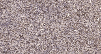 Msx-2 rabbit pAb Antibody