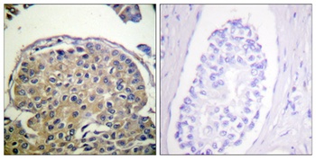 Mucin 1 (phospho Tyr1243) rabbit pAb