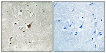 Mucin 1 (phospho Ser1227) rabbit pAb