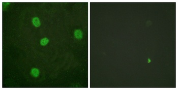 B-Myb (phospho-Ser577) antibody