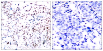 c-Myc (phospho Thr358) rabbit pAb