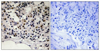 Myf-5 (phospho Ser49) rabbit pAb