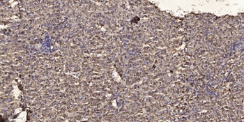 MYL6 antibody