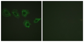 MYPT1 (phospho Thr696) rabbit pAb