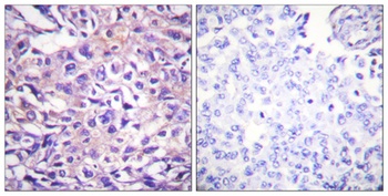 MYPT1 (phospho Thr696) rabbit pAb