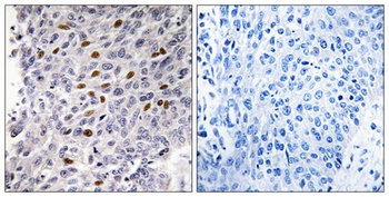 ATF-1 antibody