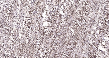 NACA (phospho Ser43) rabbit pAb