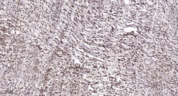 ATF-3 antibody