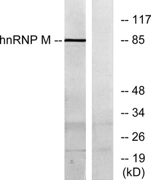 hnRNP M antibody