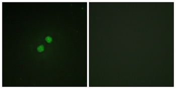 Nibrin (phospho-Ser278) antibody