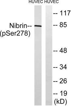 Nibrin (phospho-Ser278) antibody