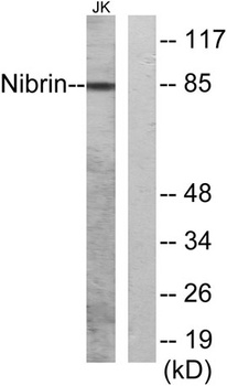 Nibrin antibody