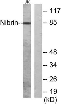 Nibrin rabbit pAb